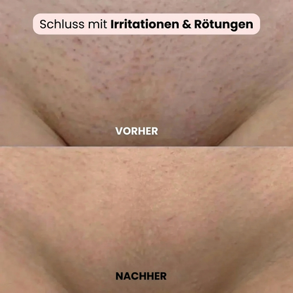 Kelya – Der 2-in-1 Rasierer für empfindliche Haut