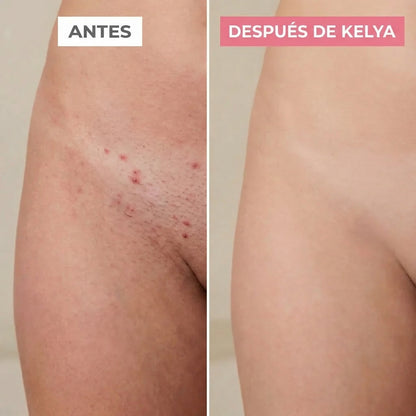 Kelya – La Maquinilla 2 en 1 para pieles sensibles