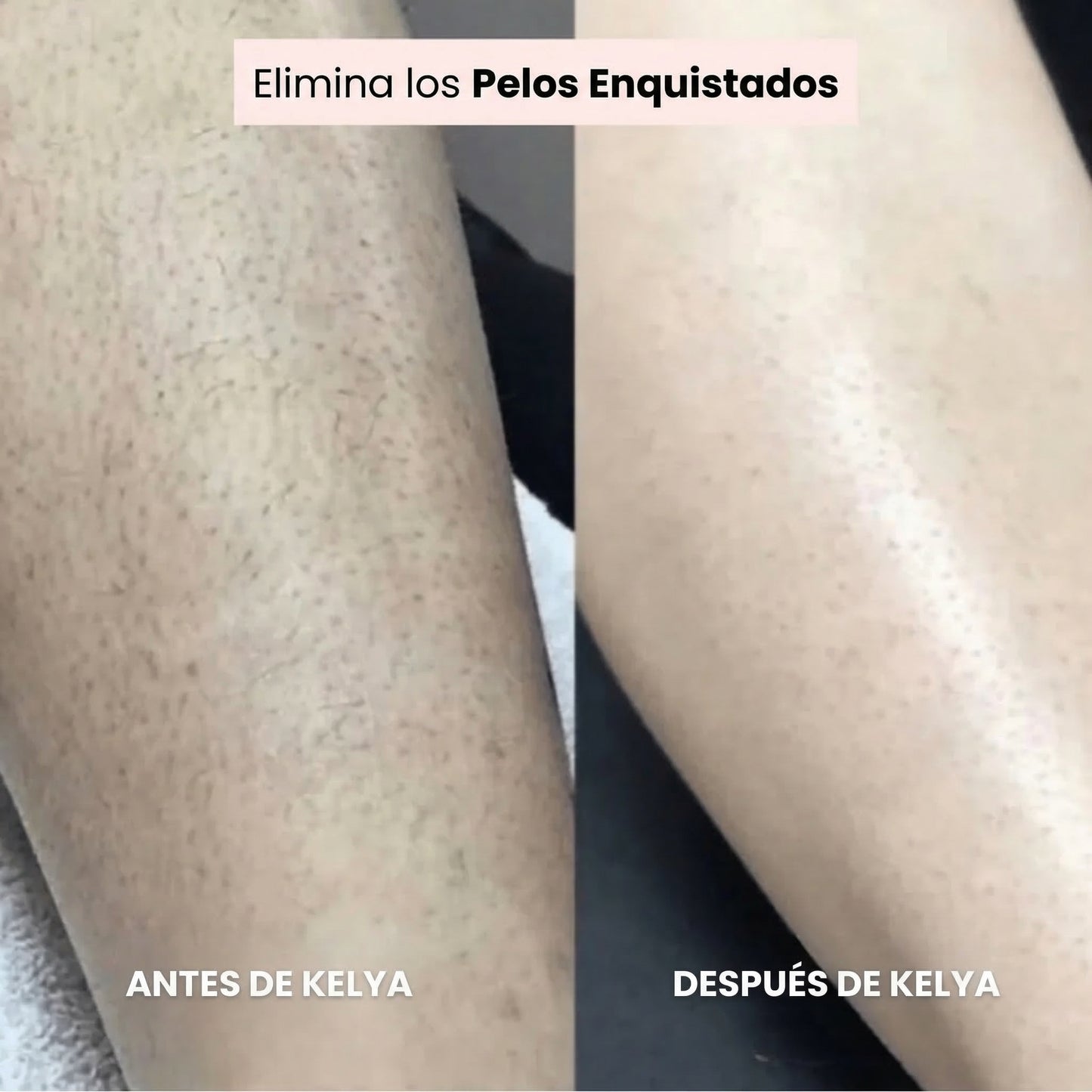 Kelya – La Maquinilla 2 en 1 para pieles sensibles