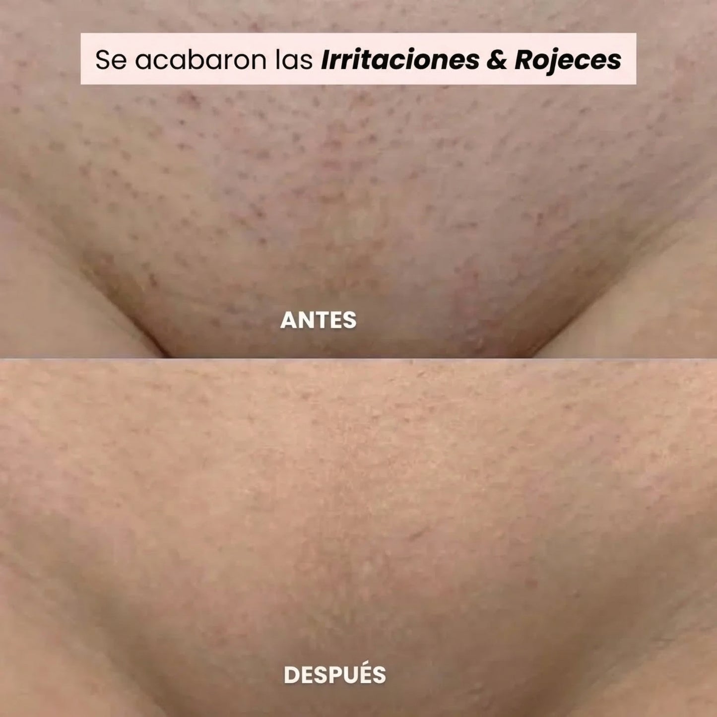 Kelya – La Maquinilla 2 en 1 para pieles sensibles