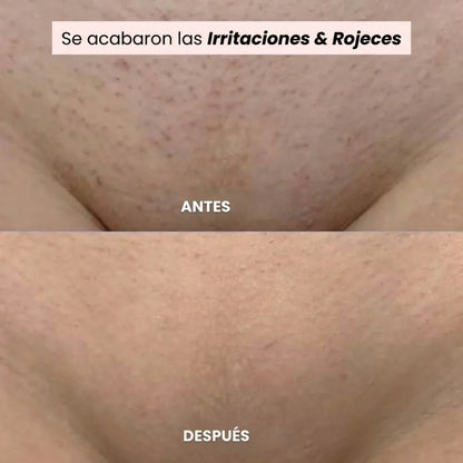 Kelya – La Maquinilla 2 en 1 para pieles sensibles